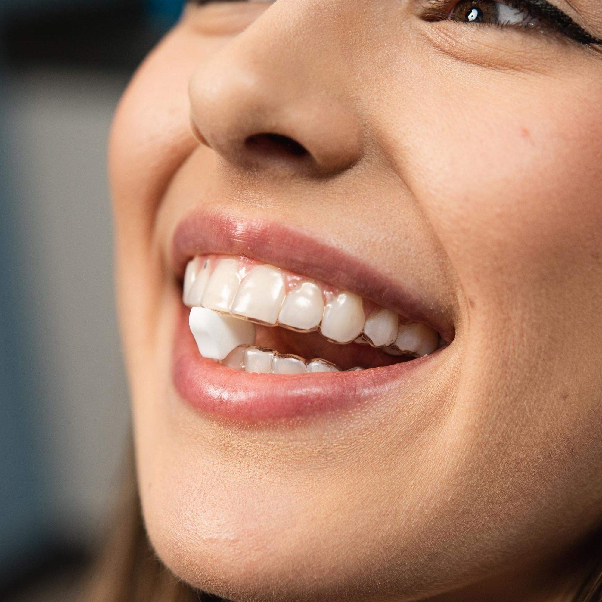 Can You Have Mints with Invisalign? The Ultimate Guide to InvisalignF