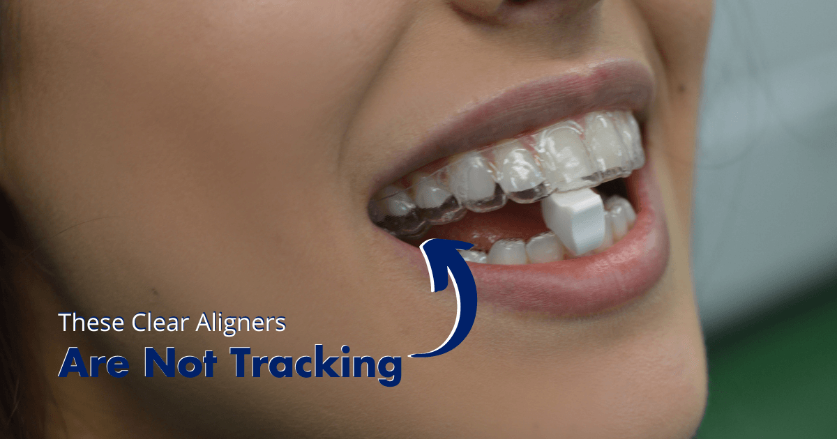 Is Your Invisalign Not Tracking? Try This