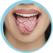 Dental Movemints Tongue Sore