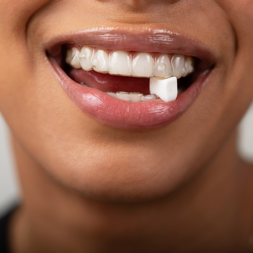 Movemints Breath Mints for Aligners | Mint Chocolate