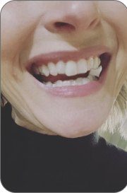 Dental Movemints Costumer