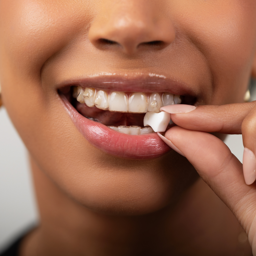 Movemints Breath Mints for Aligners | Spearmint