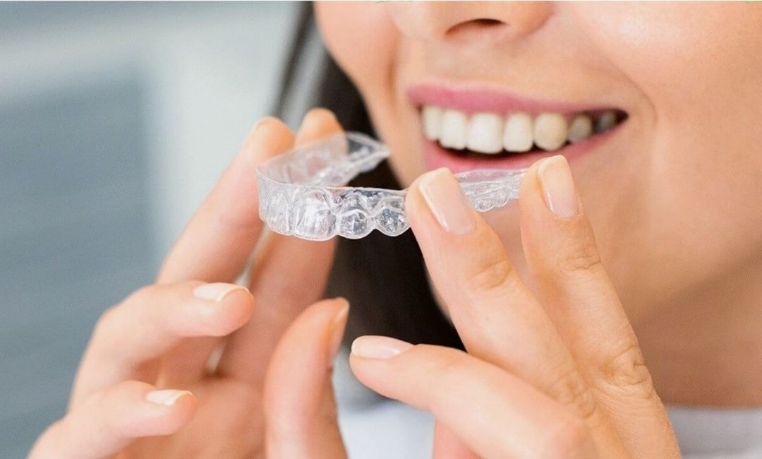 Invisalign Alternatives | Dental Movemints