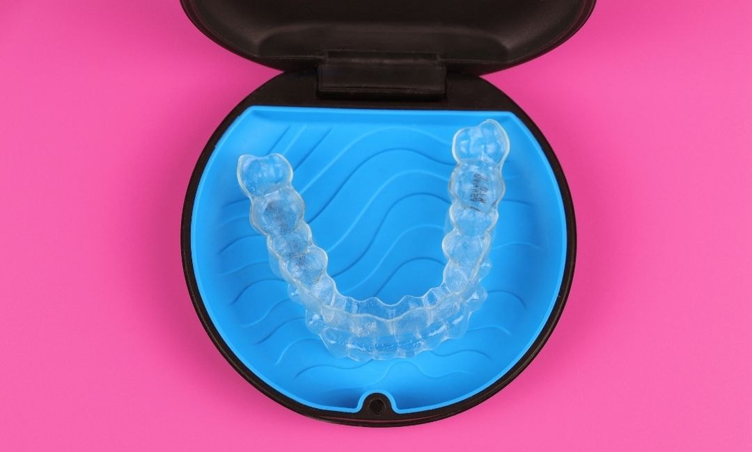 Retainers Vs Invasalign Invisalign vs Retainers | What's The Difference?