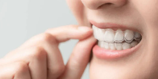 Closeup of woman with aligners on teeth, touching them with her thumb and index finger