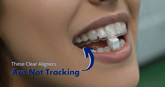person holding invisalign tray