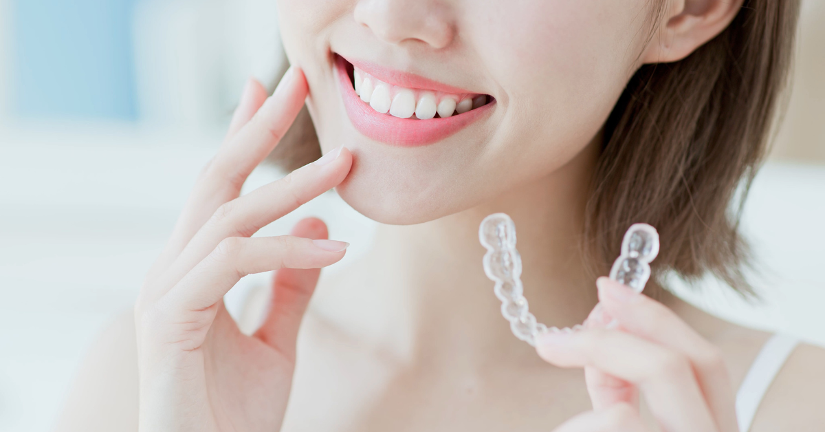 Invisalign Timeline The Complete Guide By Movemints