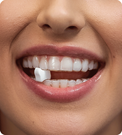 they remmove air gaps